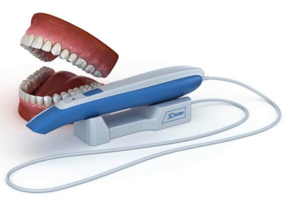 3D Scanner für Intraoral Zähne 3D Scanner für Intraoral Zähne